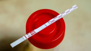 Bremerhaven: Polizei vereitelt Täuschungsversuch mit Kunstpenis und falschem Urin