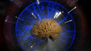 Una neuroprótesis permite expresarse a un hombre paralizado