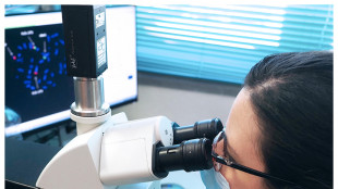 Nelle cellule immunitarie la spia di come si sta invecchiando