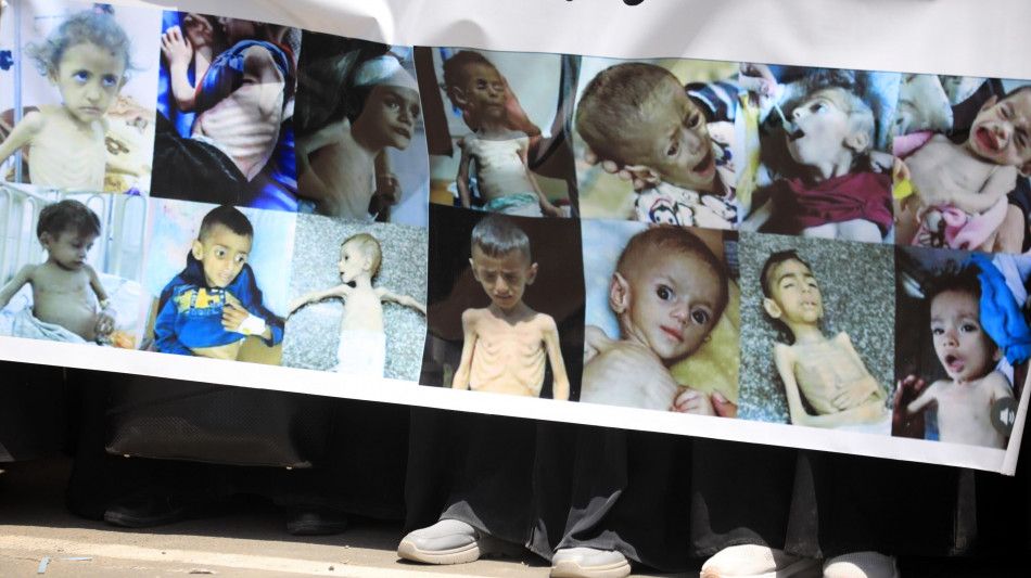 Governo Gaza, 100.000 bimbi rischiano di morire a breve