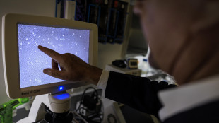 Dalla pi&ugrave; grande mappa del cervello indizi sull'invecchiamento